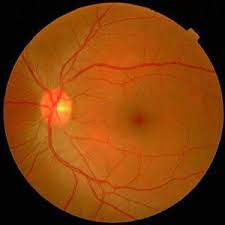 Retinal-Scan Digital Retinal Scans 